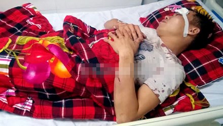 Nạn nh&acirc;n đang được điều trị tại BVĐK Cửa Đ&ocirc;ng, theo những tin tức ph&aacute;p luật mới nhất