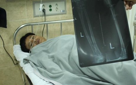 Những tin pháp luật mới nhất hôm nay đề cập đến vụ hai tên cướp táo tợn chặn xe tải, chém đứt gân tay tài xế Những tin pháp luật mới nhất hôm nay đề cập đến vụ hai tên cướp táo tợn chặn xe tải, chém đứt gân tay tài xế