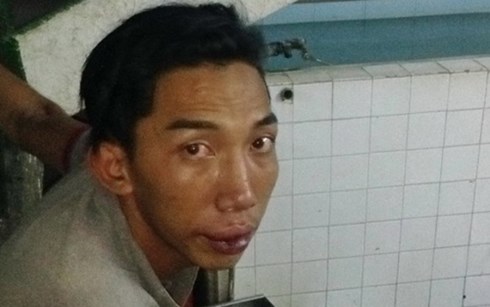 Đặc nhiệm nổ s&uacute;ng bắt nghi can giật d&acirc;y chuyền ở qu&aacute;n hủ tiếu l&agrave; một trong những tin tức ph&aacute;p luật 24h qua