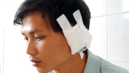 Trong những tin tức ph&aacute;p luật mới nhất h&ocirc;m nay c&oacute; vụ ma men ch&eacute;m su&yacute;t l&igrave;a tai d&acirc;n ph&ograve;ng