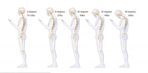 Sử dụng điện thoại c&oacute; thể g&acirc;y tho&aacute;i h&oacute;a đốt sống cổ nếu thường xuy&ecirc;n c&uacute;i gập người đọc tin nhắn hay xem ảnh