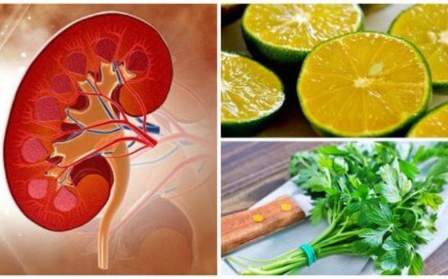 Điều trị sỏi thận từ loại nước siro tự l&agrave;m cực đơn giản