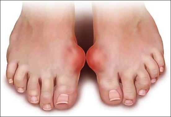 Những người n&agrave;o tuyệt đối kh&ocirc;ng được ăn măng tươi?