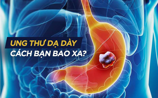 ung thu da day cach ban bao xa