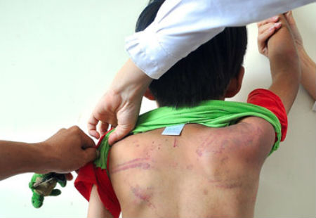 Thường ng&agrave;y, trẻ bị bạo h&agrave;nh cũng thường bị bố đ&aacute;nh đập t&agrave;n nhẫn v&igrave; những lỗi nhỏ nhặt.