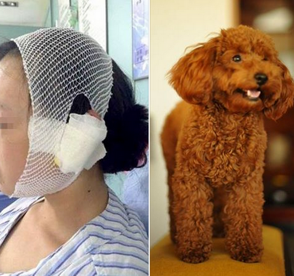 Người chủ đi&ecirc;n tiết cắn đứt tai c&ocirc; g&aacute;i v&igrave; đ&aacute; ch&uacute; ch&oacute; của m&igrave;nh