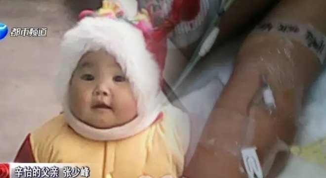 b&eacute; g&aacute;i T&acirc;n Di, 2 tuổi ở th&agrave;nh phố Lạc Dương, tỉnh H&agrave; Nam (Trung Quốc) bị h&ocirc;n m&ecirc; s&acirc;u suốt 2 tuần qua do bị tổn thương n&atilde;o.