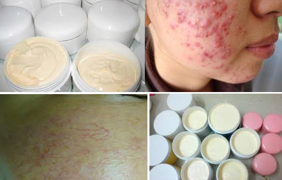 Thực hư việc tắm trắng gây ung thư da Thực hư việc tắm trắng gây ung thư da