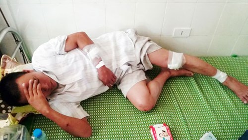 T&agrave;i xế L&acirc;n nhập viện trong t&igrave;nh trạng đa chấn thương phần mềm sau vụ truy s&aacute;t kinh ho&agrave;ng