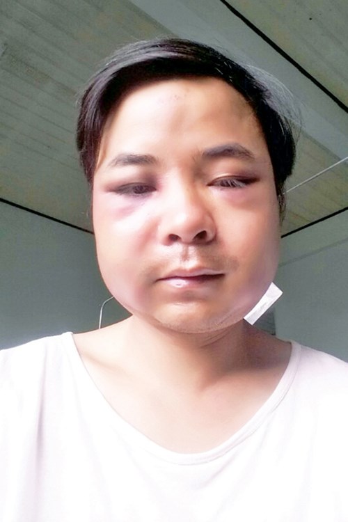 Kiểm l&acirc;m Đo&agrave;n Văn H&agrave; c&ograve;n bị nh&oacute;m c&ocirc;n đồ nghi l&agrave; l&acirc;m tặc tấn c&ocirc;ng, nhục mạ v&agrave; bắt quỳ gối giữa đường