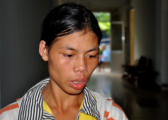Chị Hồ Thi S&acirc;m b&agrave;ng ho&agrave;ng trước quyết định tự s&aacute;t của anh Hải