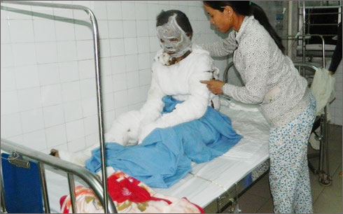 Tự thi&ecirc;u v&igrave; bị chồng bạo h&agrave;nh, thai phụ đ&atilde; tử vong do vết thương qu&aacute; nặng