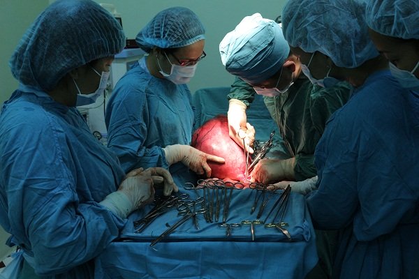 Cắt bỏi khối u &ldquo;khủng&rdquo; vượt mặt nặng 7,8kg