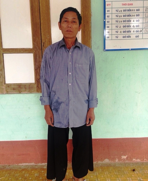 Đầu th&uacute;