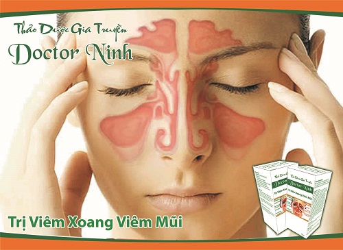 vi&ecirc;m xoang, vi&ecirc;m mũi
