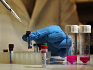 C&aacute;c nh&agrave; khoa học Đan Mạch đ&atilde; t&igrave;m ra c&aacute;ch t&aacute;ch vi r&uacute;t HIV khỏi ADN của người, từ đ&oacute; cho ph&eacute;p hệ miễn dịch ti&ecirc;u diệt vi r&uacute;t n&agrave;y - Ảnh: AFP