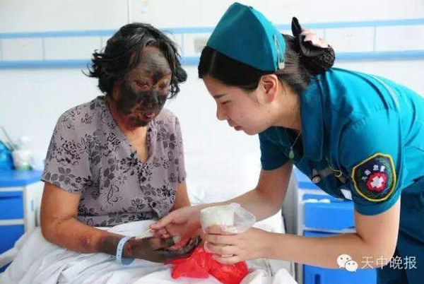 L&yacute; do khiến cụ b&agrave; 70 su&yacute;t mất mạng v&igrave; ăn rau dền