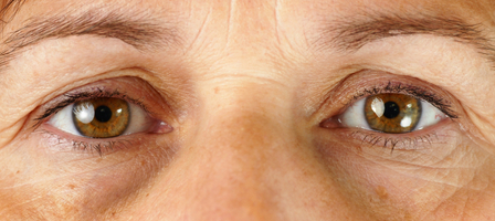 Ăn g&igrave; để loại bỏ nếp nhăn v&ugrave;ng mắt?