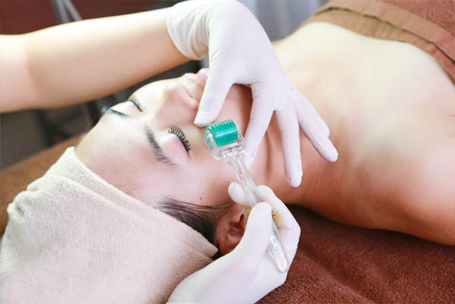Hoại tử da mặt, l&acirc;y bệnh truyền nhiễm&hellip; v&igrave; l&agrave;m đẹp kiểu lăn kim