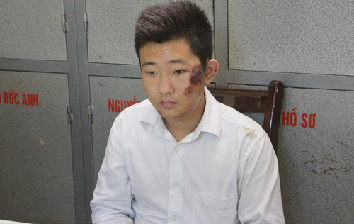 Bảo vệ Đào Quang Khánh ở Thẩm mỹ viện Cát Tường ban đầu không muốn 