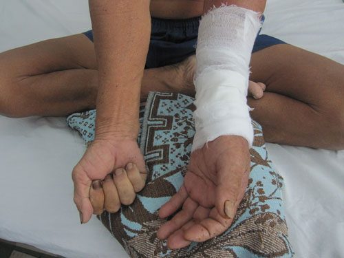 đắp thuốc v&ocirc; tội vạ rất nguy hiểm