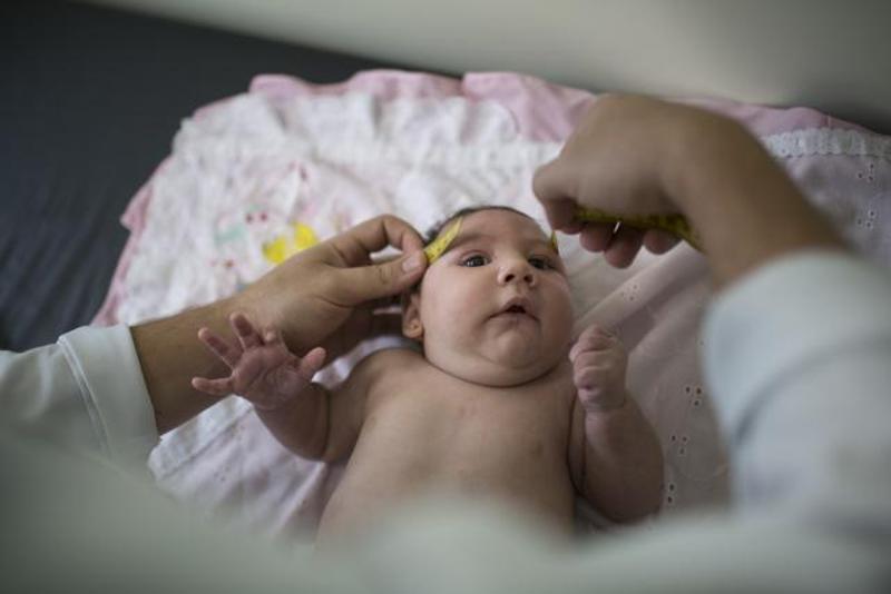 Trung Quốc đ&atilde; ghi nhận trường hợp đầu ti&ecirc;n nhiễm virus Zika g&acirc;y bệnh đầu nhỏ