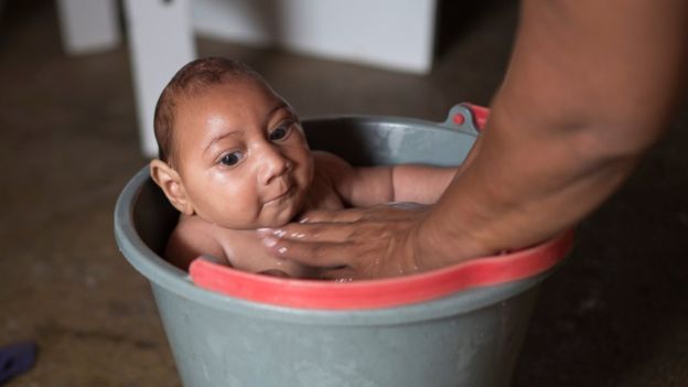 Hiện số quốc gia xuất hiện virus Zika g&acirc;y bệnh đầu nhỏ kh&ocirc;ng ngừng gia tăng