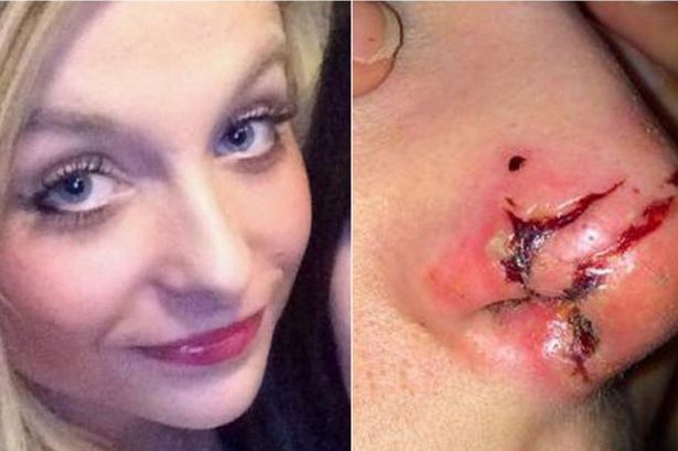 Vụ &aacute;n hy hữu khi Laura bị một phụ nữ tấn c&ocirc;ng d&atilde; man v&agrave;o mặt ngay tr&ecirc;n phố