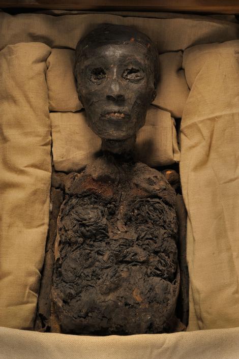 Pharaoh Tutankhamun: Vị vua Ai Cập nổi tiếng này là kết quả của một cuộc hôn nhân cận huyết, đây cũng chính là nguyên nhân khiến chân của vua Tut bị dị tật bẩm sinh, thậm chí còn khiến ông không sinh được con nối dõi với người vợ đồng thời cũng là chị cùng huyết thống của mình. Ảnh Kenneth Garrett/ National Geographic