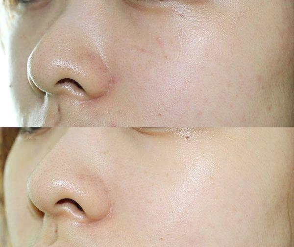 Tuyệt chi&ecirc;u đắp mặt nạ si&ecirc;u đỉnh c&ugrave;ng c&aacute;ch đ&aacute;nh son Mac l&acirc;u tr&ocirc;i n&agrave;ng đ&atilde; biết?
