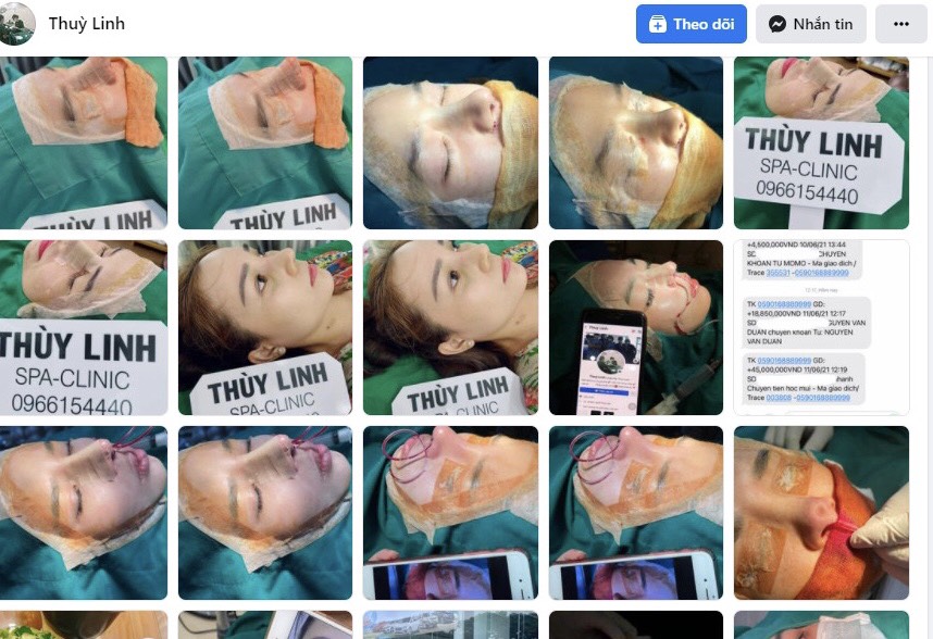 Cẩn trọng với b&aacute;c sĩ Th&ugrave;y Linh tr&ecirc;n facebook: Thẩm mỹ hỏng rồi &lsquo;phủi tay&rsquo;?