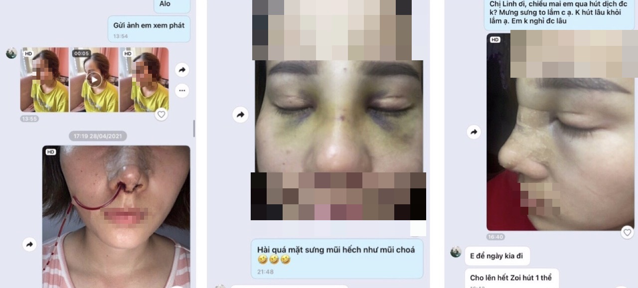 Cẩn trọng với b&aacute;c sĩ Th&ugrave;y Linh tr&ecirc;n facebook: Thẩm mỹ hỏng rồi &lsquo;phủi tay&rsquo;?