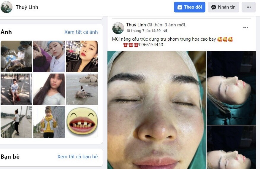 Thẩm mỹ Th&ugrave;y Linh tr&ecirc;n Facebook: Thẩm mỹ chui, vi phạm quy định ph&ograve;ng dịch
