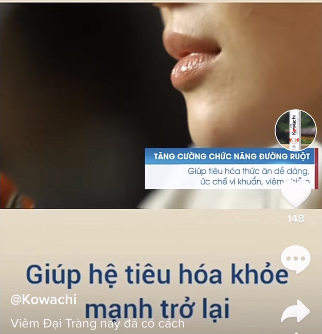 Vi&ecirc;n sủi Kowachi: Chỉ l&agrave; 13Win OKVIP Cá cược bóng đá bảo vệ 13Win19 ưu đãi hấp dẫn vẫn 'nổ' c&ocirc;ng dụng như thuốc trị bệnh