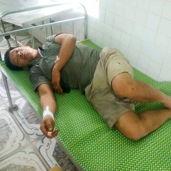 Nổ m&igrave;n ở xưởng đ&aacute; T&acirc;n Sơn