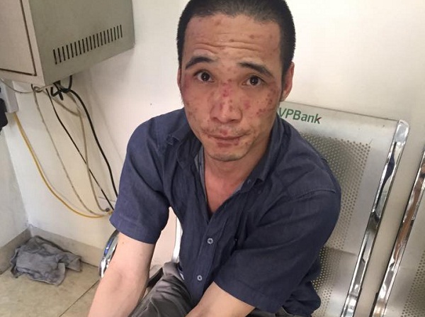 Đối tượng Nguyễn Th&agrave;nh Long
