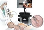 Cảnh báo nguy cơ lây nhiễm bệnh từ các thiết bị nội soi
