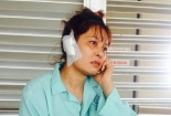 Một phụ nữ bị chồng cắn rớt tai