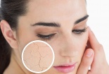 Lưu ý đặc biệt khi dùng kem dưỡng ngăn ngừa lão hóa