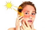 Phát hiện Vitamin B3 bảo vệ tế bào da khỏi tác động của tia cực tím