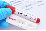 Test Covid-19 qua nước bọt nhanh và an toàn hơn ngoáy mũi