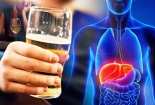Cứu chữa kịp thời bệnh nhân suy đa tạng sau chầu rượu