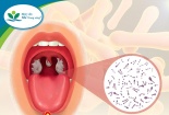 Tăng cường công tác phòng, chống bệnh bạch hầu