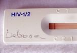 Thu hồi khẩn cấp 500.000 bộ xét nghiệm HIV "đểu"