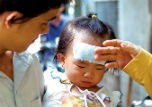 Sử dụng miếng dán hạ sốt: Tiện chưa chắc lợi