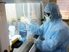 Bộ Y tế cảnh báo xuất hiện chủng virus nguy hiểm