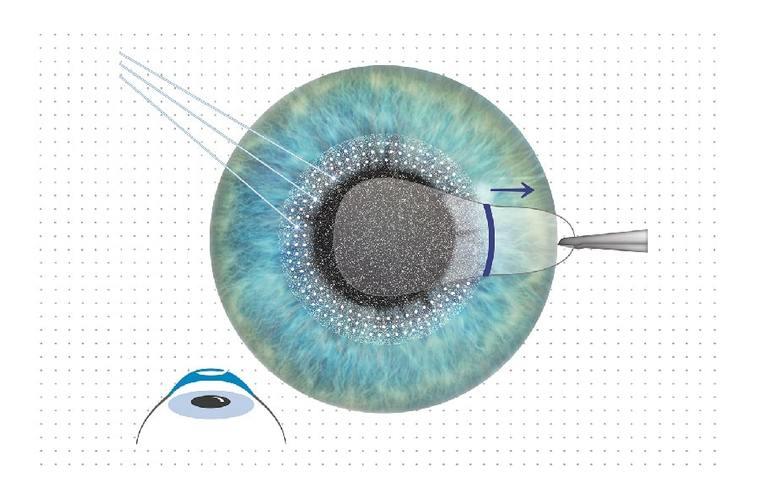 Cảnh giác trước khi mua hàng một giá