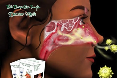 Thảo dược gia truyền Doctor Ninh đặc trị viêm mũi dị ứng