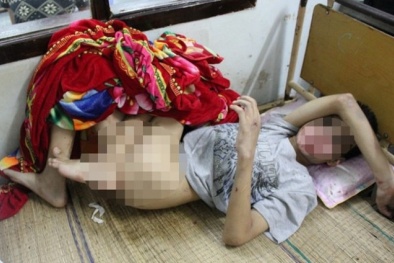 Rợn người nghi án bé trai tật nguyền bị người thuê trọ lạm dụng tình dục