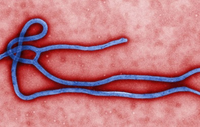 Vì sao virus Ebola nguy hiểm